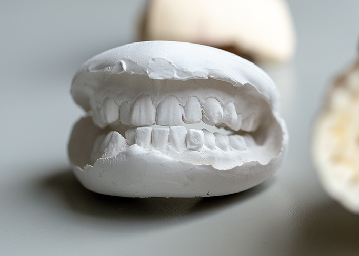 東十条の歯医者、医療法人社団医智会 Premium Dental Salon IKEIの審美・セラミック治療