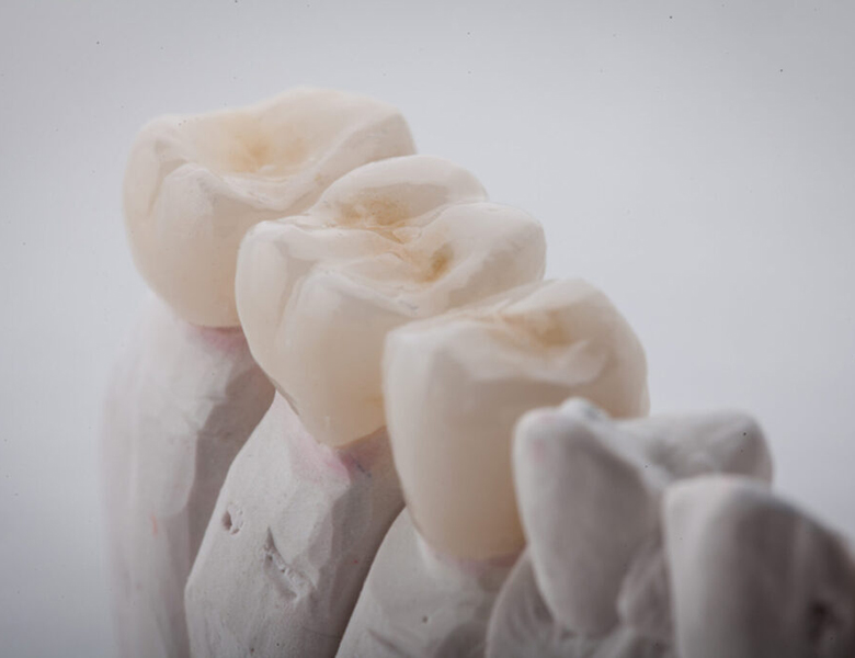 東十条の歯医者、医療法人社団医智会 Premium Dental Salon IKEIは日本補綴歯科学会終身指導医監修