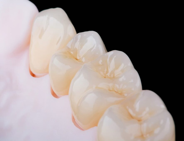 東十条の歯医者、医療法人社団医智会 Premium Dental Salon IKEIの審美・セラミック治療