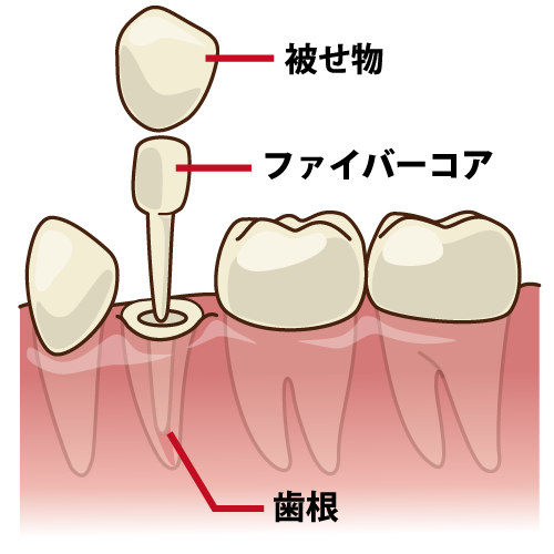 東十条の歯医者、医療法人社団医智会 Premium Dental Salon IKEIのマイクロスコープ精密治療