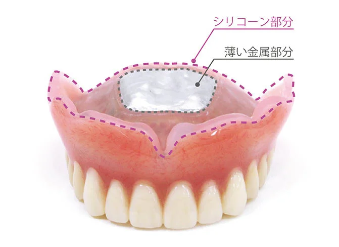 東十条の歯医者、医療法人社団医智会 Premium Dental Salon IKEIの入れ歯（義歯）