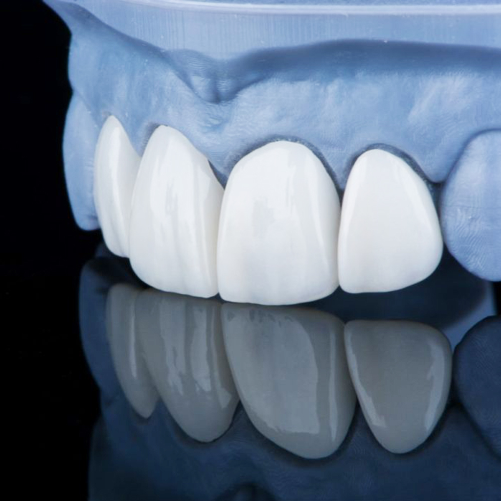 東十条の歯医者、医療法人社団医智会 Premium Dental Salon IKEIの審美歯科治療