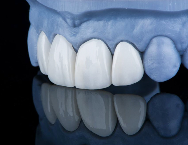東十条の歯医者、医療法人社団医智会 Premium Dental Salon IKEIの審美歯科治療