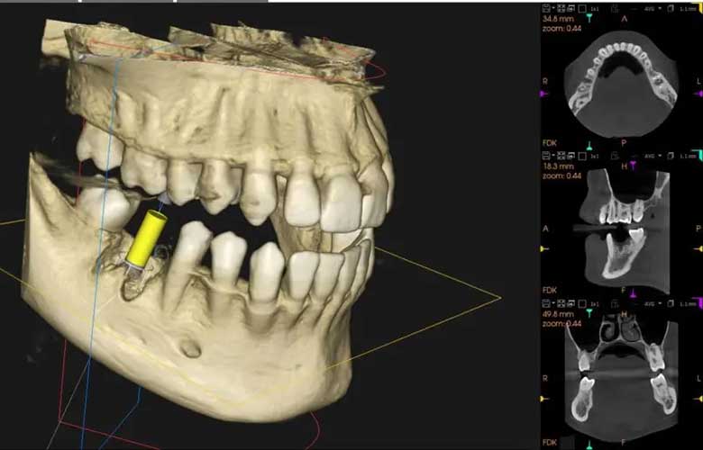東十条の歯医者、医療法人社団医智会 Premium Dental Salon IKEIの歯科用CT精密診断