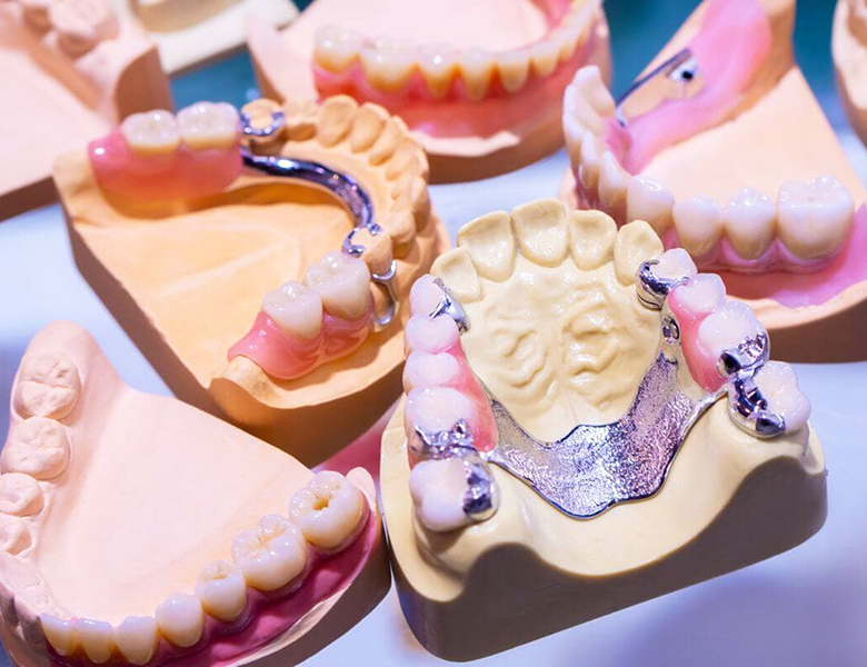 東十条の歯医者、医療法人社団医智会 Premium Dental Salon IKEIは日本補綴歯科学会終身指導医監修