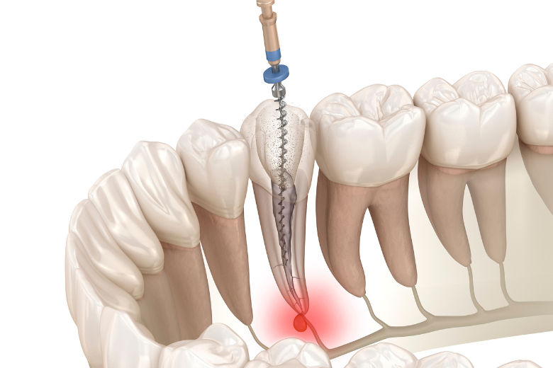 東十条の歯医者、医療法人社団医智会 Premium Dental Salon IKEIのマイクロスコープ精密治療