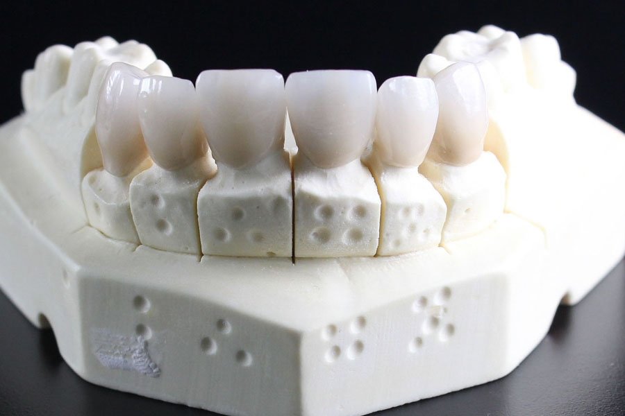 東十条の歯医者、医療法人社団医智会 Premium Dental Salon IKEIの審美・セラミック治療
