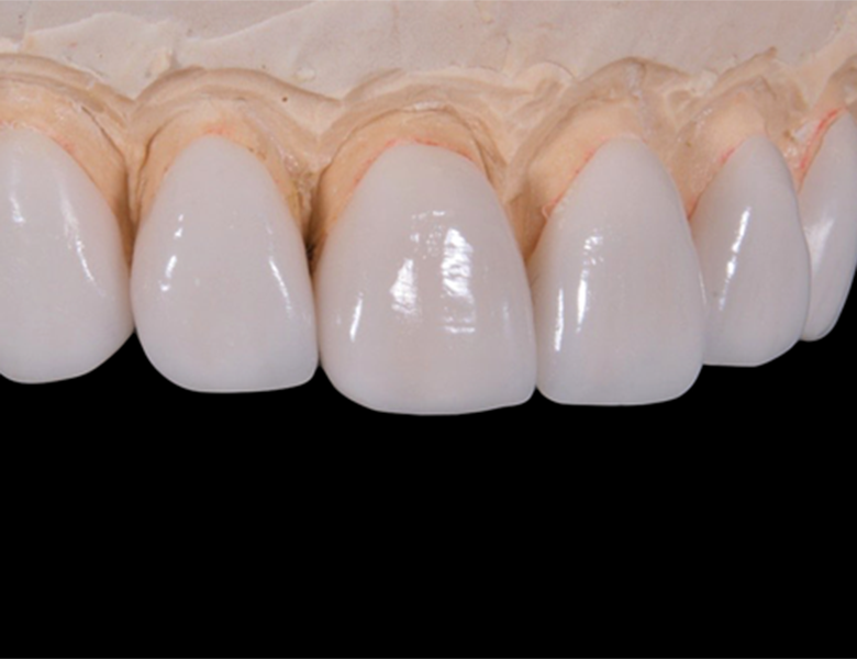 東十条の歯医者、医療法人社団医智会 Premium Dental Salon IKEIは日本補綴歯科学会終身指導医監修