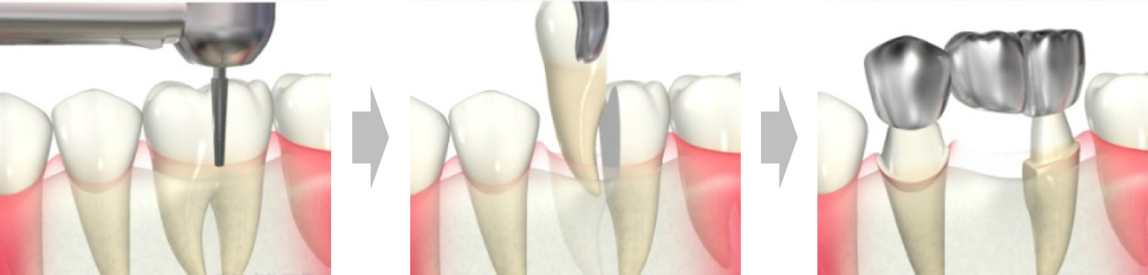東十条の歯医者、医療法人社団医智会 Premium Dental Salon IKEIのマイクロスコープ精密治療