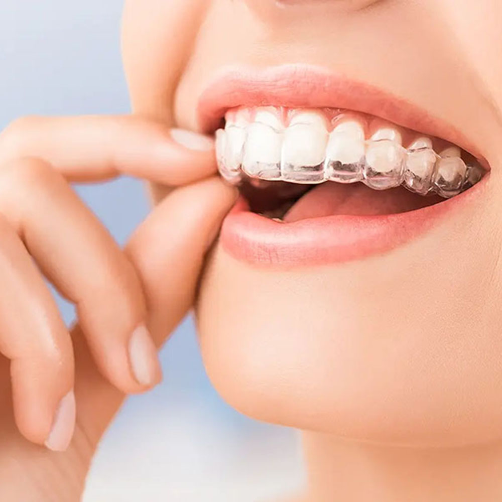 東十条の歯医者、医療法人社団医智会 Premium Dental Salon IKEIのマウスピース矯正
