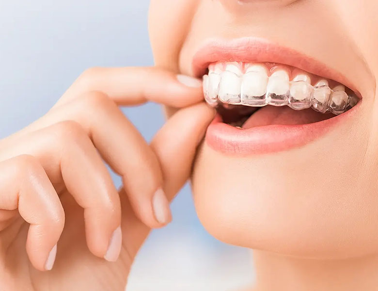 東十条の歯医者、医療法人社団医智会 Premium Dental Salon IKEIのマウスピース矯正