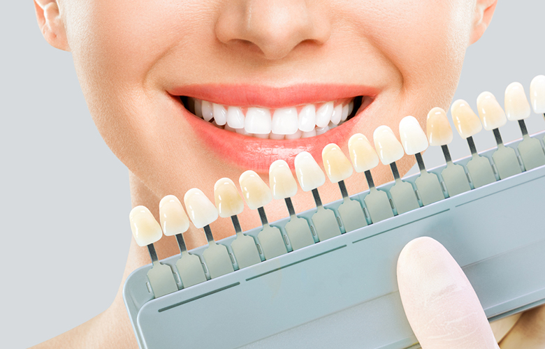 東十条の歯医者、医療法人社団医智会 Premium Dental Salon IKEIのホワイトニング