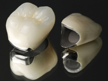 東十条の歯医者、医療法人社団医智会 Premium Dental Salon IKEIの審美・セラミック治療