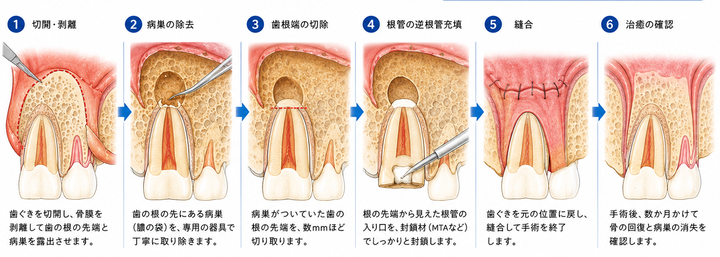 東十条の歯医者、医療法人社団医智会 Premium Dental Salon IKEIのマイクロスコープ精密治療