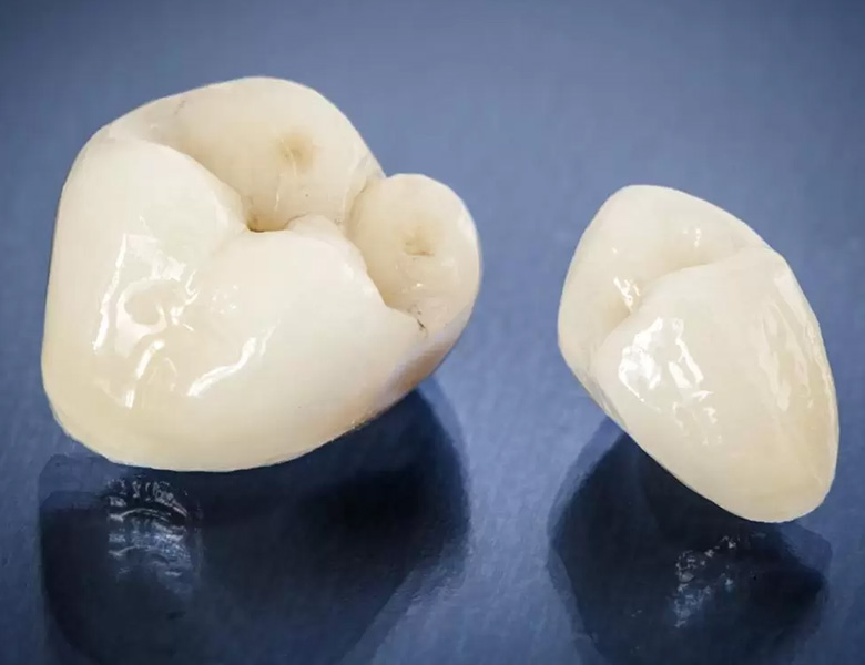 東十条の歯医者、医療法人社団医智会 Premium Dental Salon IKEIの審美歯科治療