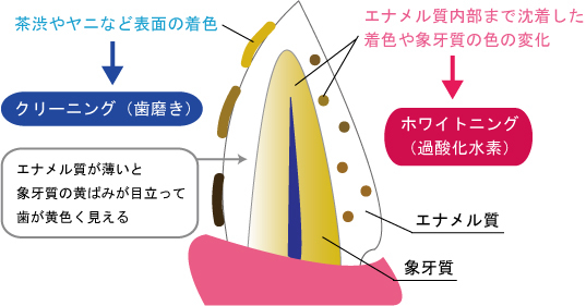 東十条の歯医者、医療法人社団医智会 Premium Dental Salon IKEIのホワイトニング