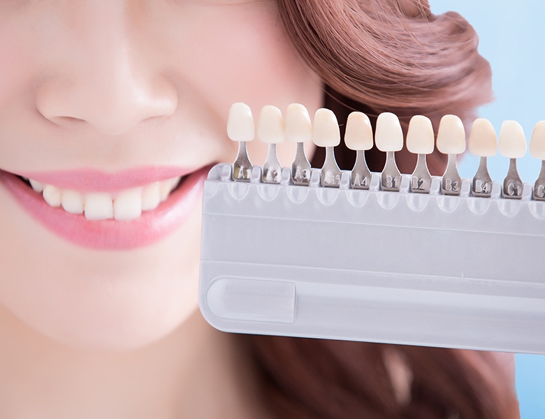 東十条の歯医者、医療法人社団医智会 Premium Dental Salon IKEIのホワイトニング
