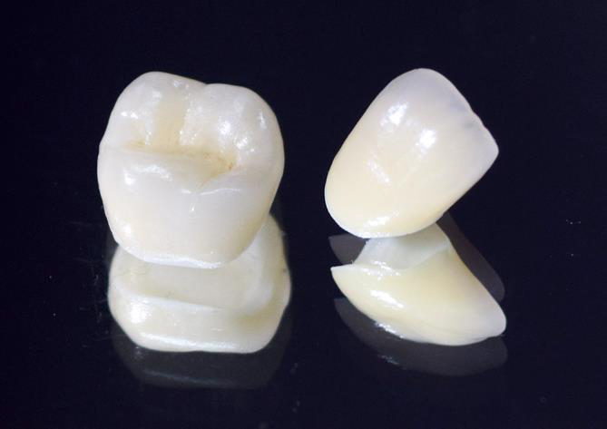 東十条の歯医者、医療法人社団医智会 Premium Dental Salon IKEIの審美・セラミック治療
